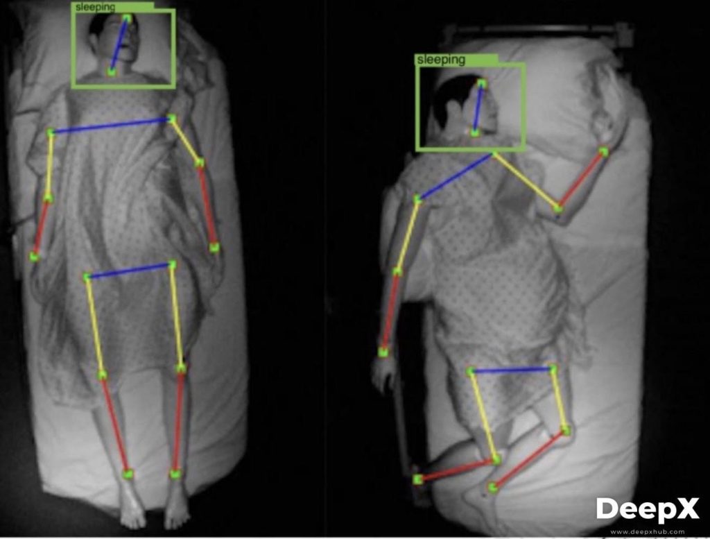 Computer Vision Healthcare Pose Estimation Example 